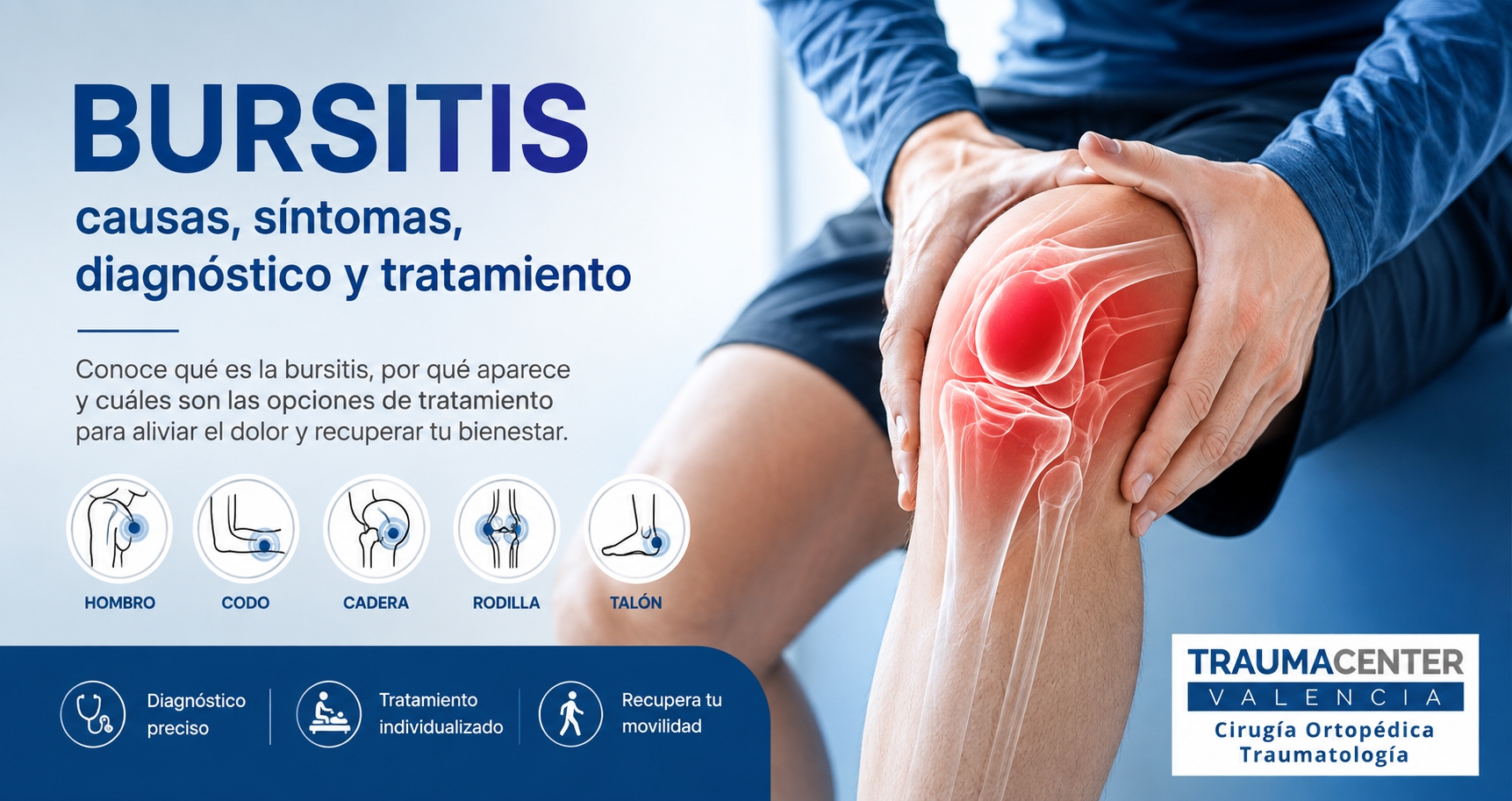 Bursitis: causas, síntomas, diagnóstico y tratamiento