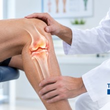 Artrosis de rodilla y su evolución: cómo avanza la enfermedad y qué tratamientos existen